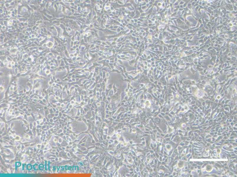 MFM-223 Cell Complete MediumMFM-223 Cell Complete Medium - 1