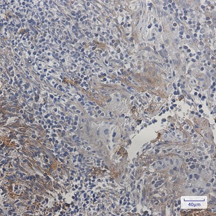 Recombinant SMAC/Diablo Monoclonal Antibody - 3