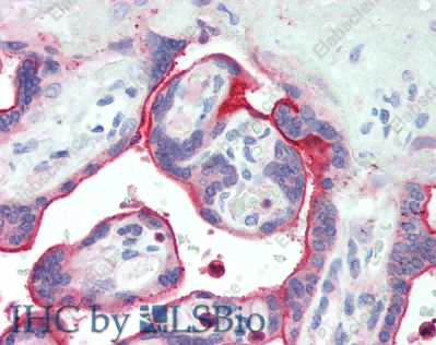 NECTIN4 Polyclonal Antibody - 4