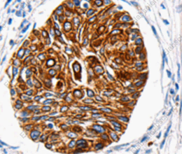 HTR1A Polyclonal Antibody - 2