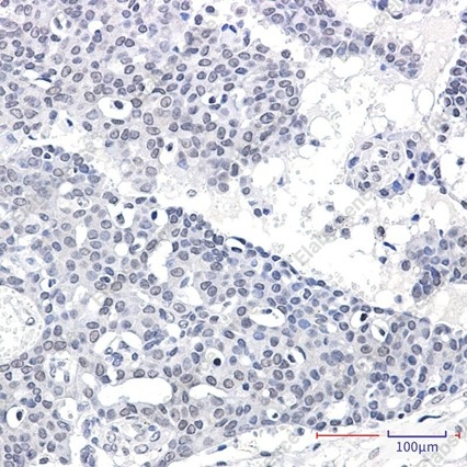 Recombinant SPT5 Monoclonal Antibody - 3
