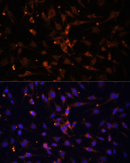 Immunofluorescence analysis of C6 cells using AMPKalpha2 Polyclonal Antibody at dilution of 1:100 (40x lens). Blue: DAPI for nuclear staining.
