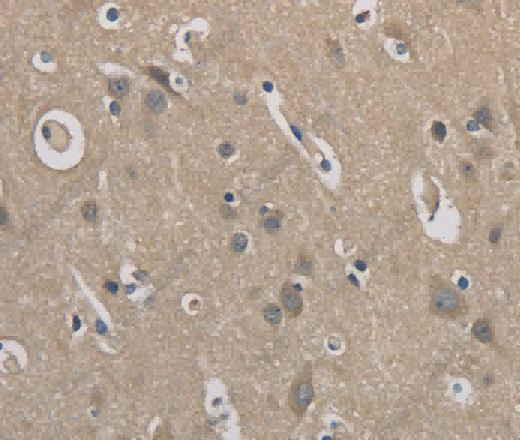 EMC8 Polyclonal Antibody - 3