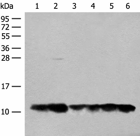 Western blot analysis of 293T cell Human fetal liver tissue lysates  using ATP5L Polyclonal Antibody at dilution of 1:500