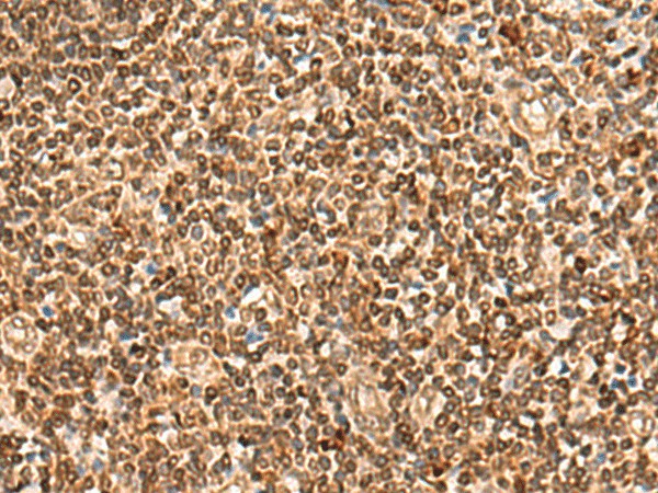 Immunohistochemistry of paraffin-embedded Human tonsil tissue  using HOXC12 Polyclonal Antibody at dilution of 1:50(?200)