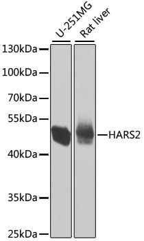 Western blot analysis of extracts of various cell lines using HARS2 Polyclonal Antibody at 1:1000 dilution.