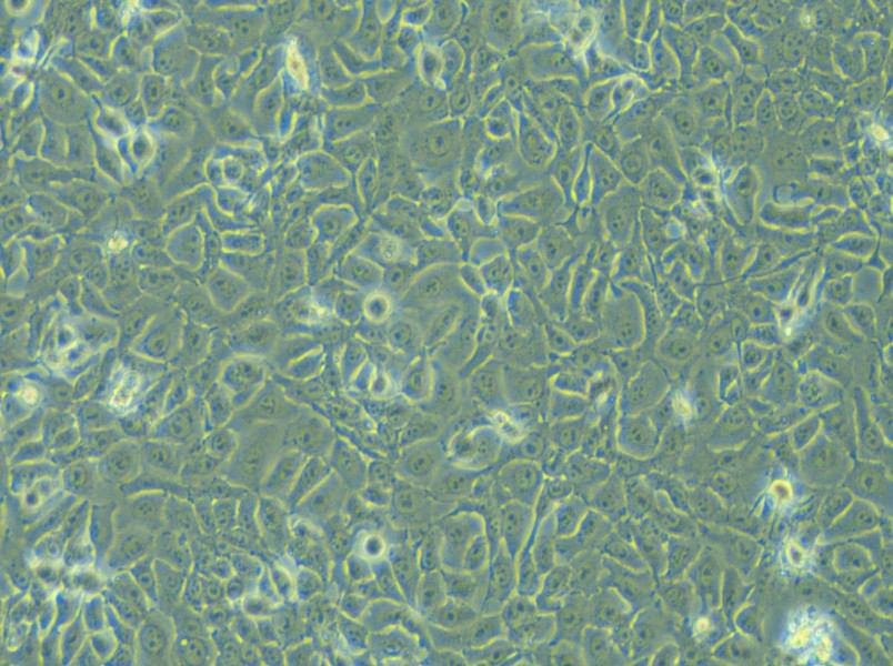 KYSE-450 Cell Complete Medium - 5