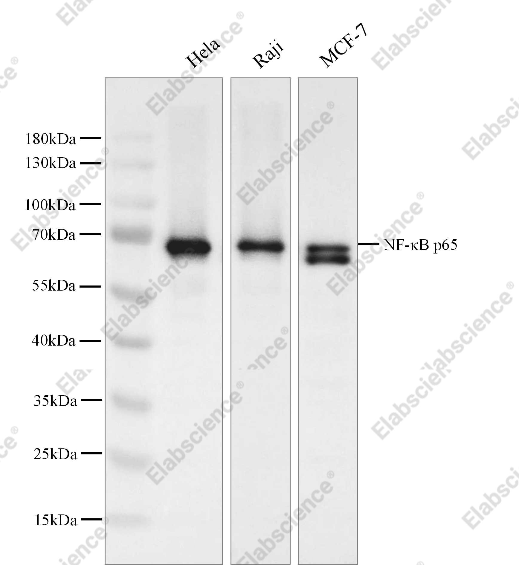 Recombinant NF-κB p65 Monoclonal Antibody - 1