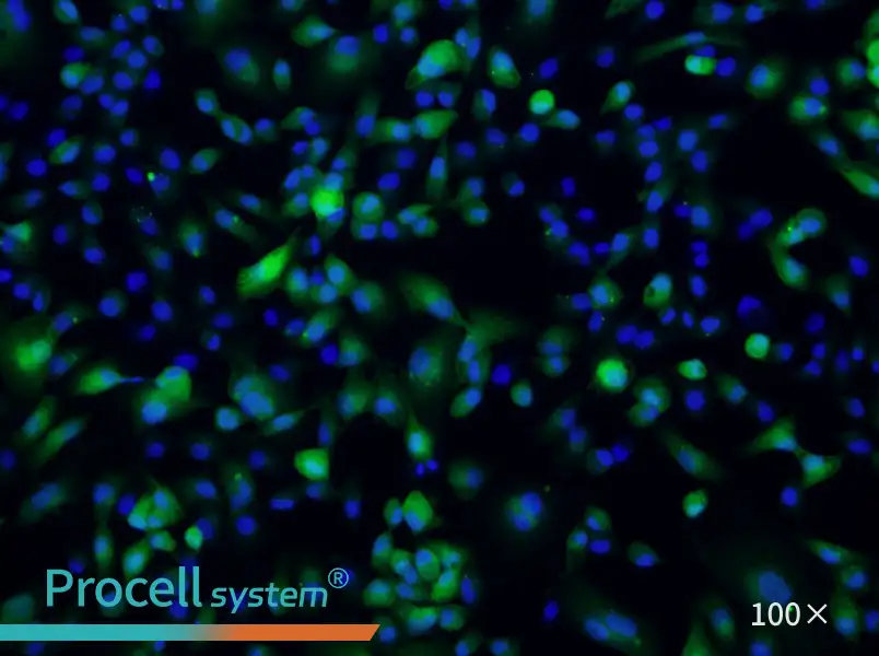 ACHN-GFP Cell Complete Medium - 1