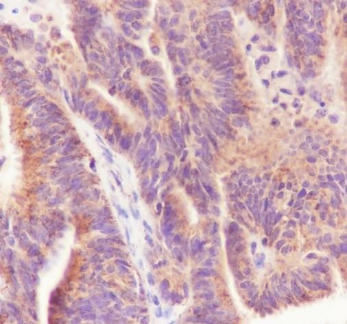 Recombinant Tec Monoclonal Antibody - 3