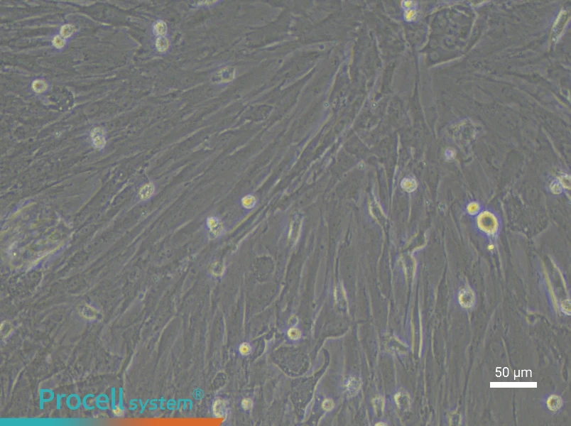 Rat Pancreatic Stellate Cell Complete Medium - 6