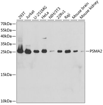 Western blot analysis of extracts of various cell lines using PSMA2 Polyclonal Antibody at dilution of 1:1000.