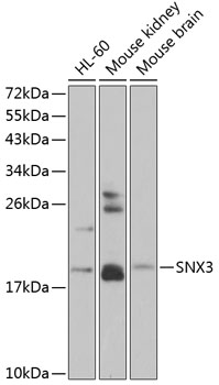 Western blot analysis of extracts of various cell lines using SNX3 Polyclonal Antibody at 1:1000 dilution.