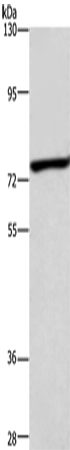 Western Blot analysis of Mouse heart tissue using ABCB8 Polyclonal Antibody at dilution of 1:600