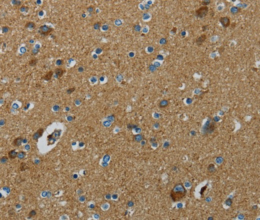 Immunohistochemistry of paraffin-embedded Human brain  tissue using PPARGC1B Polyclonal Antibody at dilution 1:30