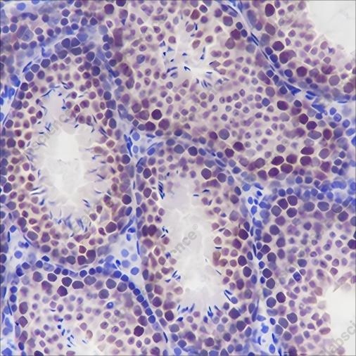 Recombinant ELP3 Monoclonal Antibody - 3