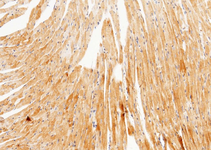 Recombinant UCHL3 Monoclonal Antibody-searchlist-1
