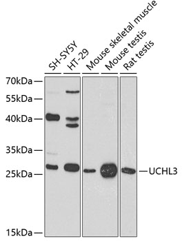 Western blot analysis of extracts of various cell lines using UCHL3 Polyclonal Antibody at 1:1000 dilution.