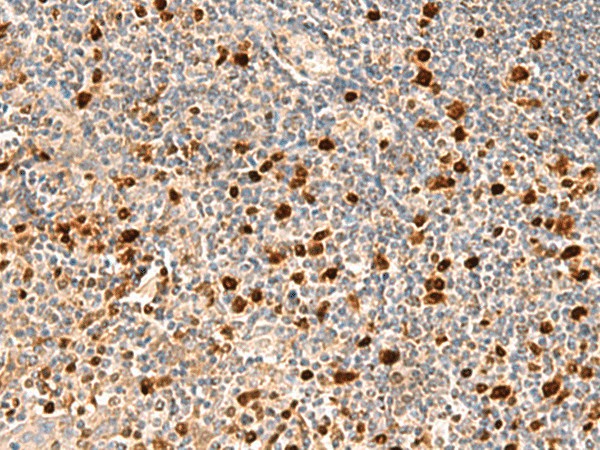 Immunohistochemistry of paraffin-embedded Human tonsil tissue  using DUT Polyclonal Antibody at dilution of 1:70(?200)