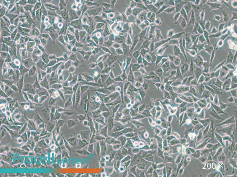 CHP-212 Cell Complete Medium - 6