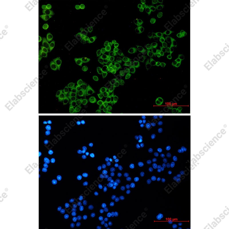 Recombinant GPCR LGR6 Monoclonal Antibody - 2