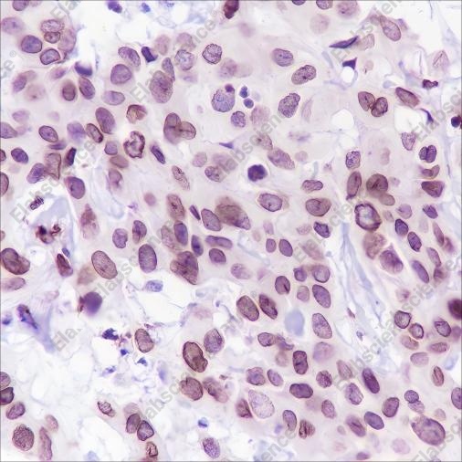 Recombinant FBXW7 Monoclonal Antibody - 1