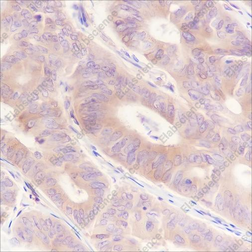 Recombinant CRMP2 Monoclonal Antibody - 3