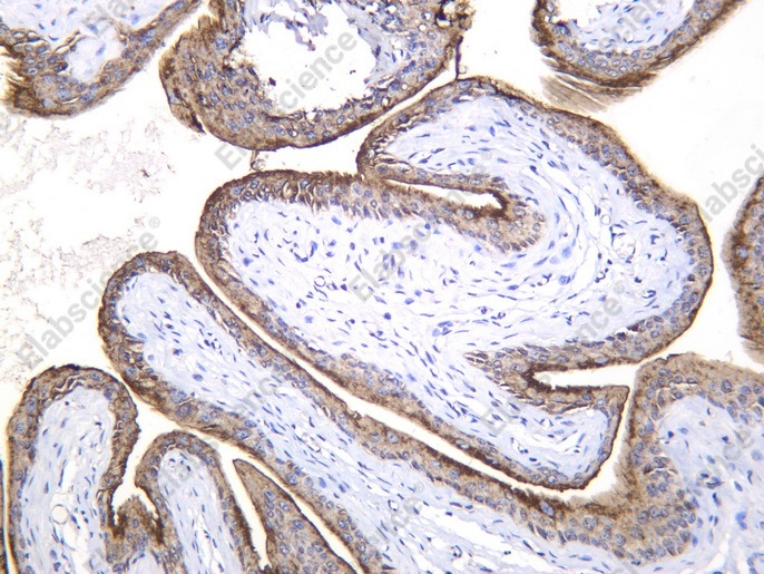 Recombinant Uroplakin III Monoclonal Antibody - 2