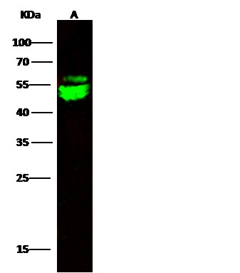 Recombinant CNDP2 Monoclonal Antibody-searchlist-1