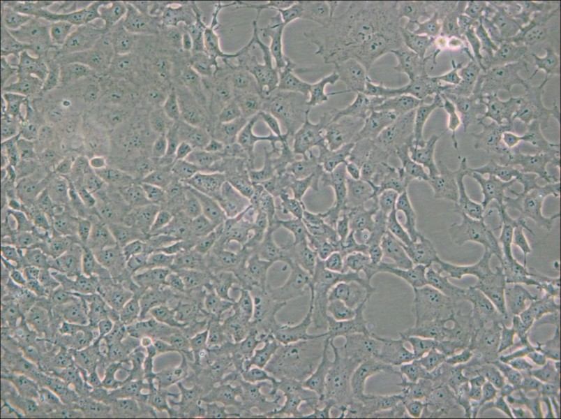 PA-1 Cell Complete Medium - 4