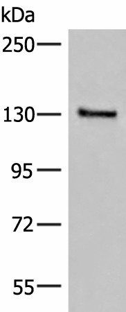 Western blot analysis of Human urinary bladder tissue lysate  using SASH1 Polyclonal Antibody at dilution of 1:300