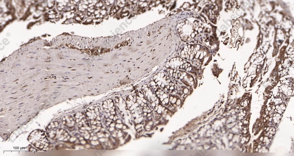 Recombinant TATA Box Binding Protein Monoclonal Antibody - 3