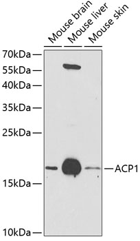 Western blot analysis of extracts of various cell lines using ACP1 Polyclonal Antibody at 1:1000 dilution.