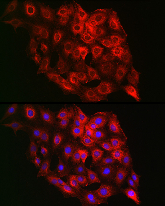 Immunofluorescence analysis of C6 cells using PSMD8 Polyclonal Antibody at dilution of 1:100 (40x lens). Blue: DAPI for nuclear staining.