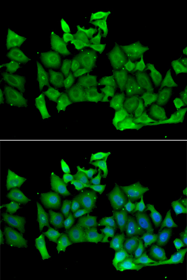 Immunofluorescence analysis of MCF-7 cells using RHOH Polyclonal Antibody