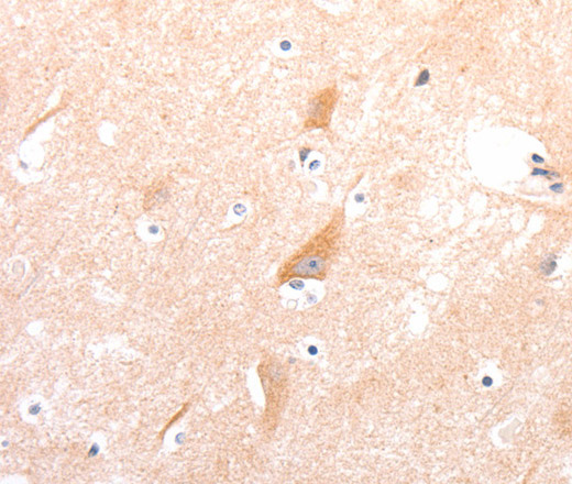 Immunohistochemistry of paraffin-embedded Human brain tissue using CELSR2 Polyclonal Antibody at dilution 1:50