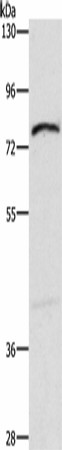 Western blot analysis of Mouse intestinum tenue tissue  using XPNPEP1 Polyclonal Antibody at dilution of 1:600