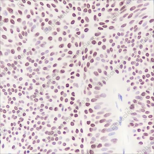 Recombinant HMGA1 Monoclonal Antibody - 4