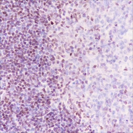 Recombinant SATB1 Monoclonal Antibody - small - 2
