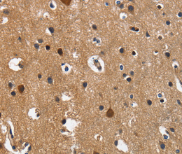 CD27 Polyclonal Antibody - 3