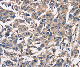PEBP1 Polyclonal Antibody - 3