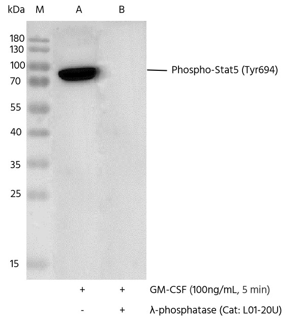 Recombinant Phospho-Stat5 (Tyr694) Monoclonal Antibody - small - 3