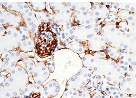 Recombinant CD38 Monoclonal Antibody-searchlist-1