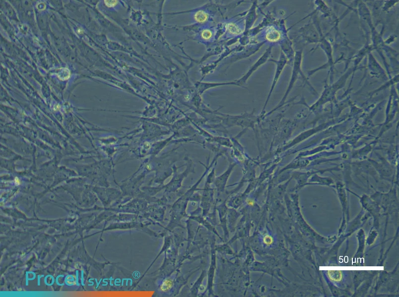 Rat Brain Fibroblast Complete Medium - 5