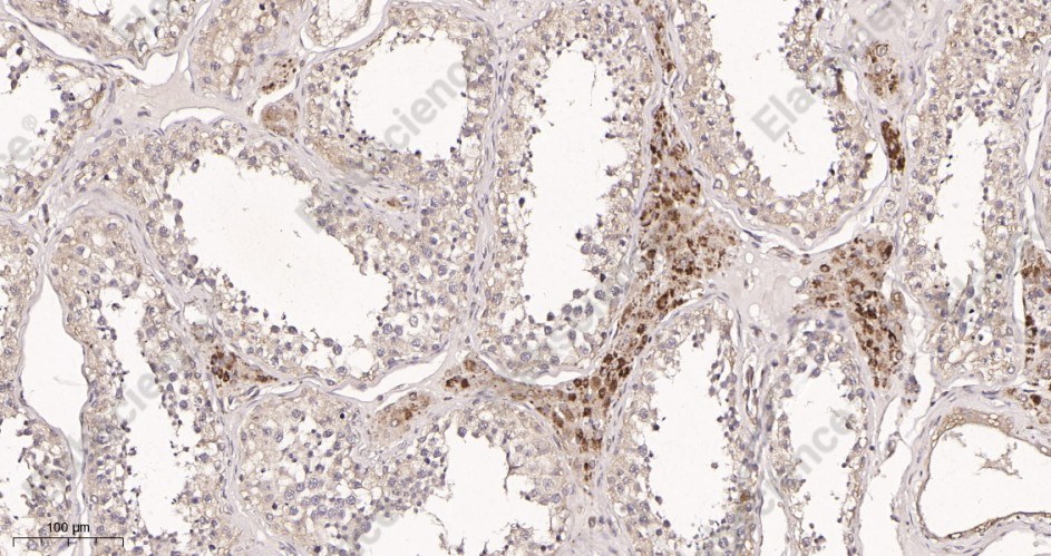 Recombinant ROCK1 Monoclonal Antibody - 2