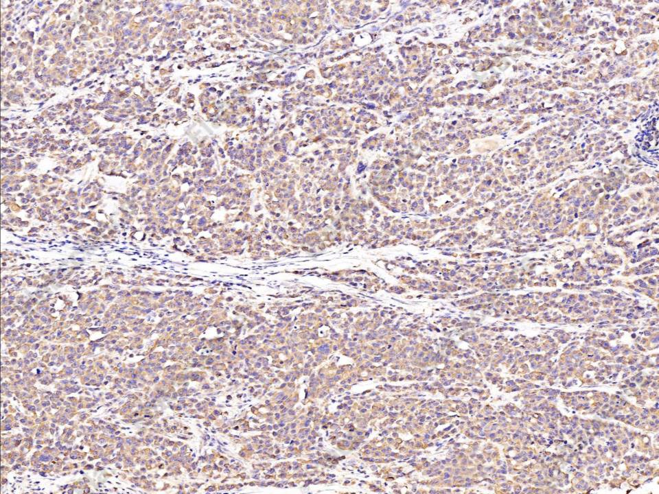 Recombinant BID Monoclonal Antibody - 1