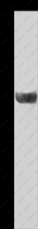 HSD17B2 Polyclonal Antibody - 1
