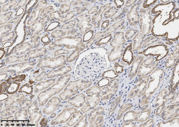 Bcl-XL Monoclonal Antibody-searchlist-1