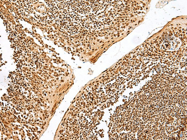 Immunohistochemistry of paraffin-embedded Human tonsil tissue  using GRSF1 Polyclonal Antibody at dilution of 1:30(?200)