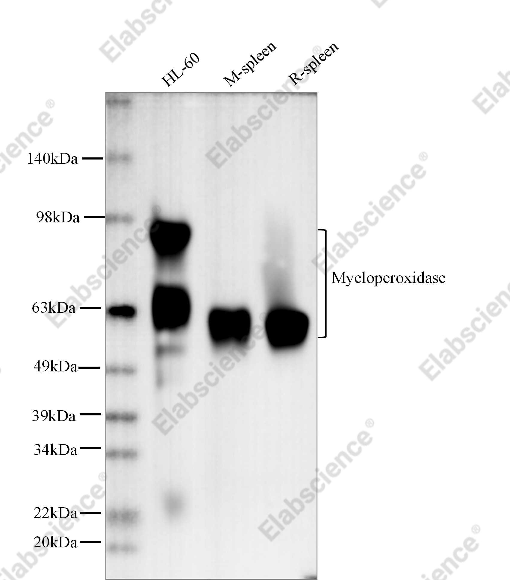 Recombinant Myeloperoxidase Monoclonal Antibody - 1